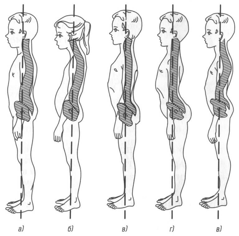 Осанка – это положение, в котором человек держит свое тело