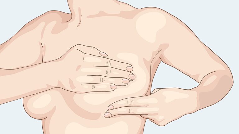 Рак молочной железы